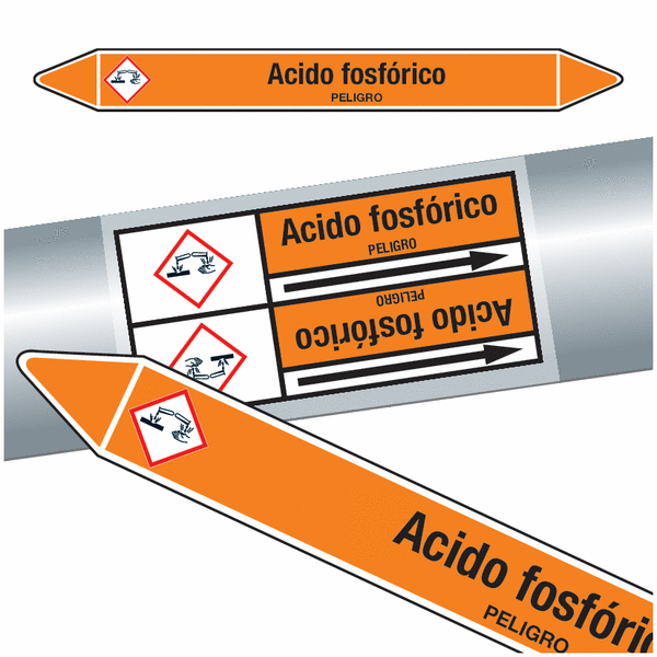 Intoxicación por ácido fosfórico