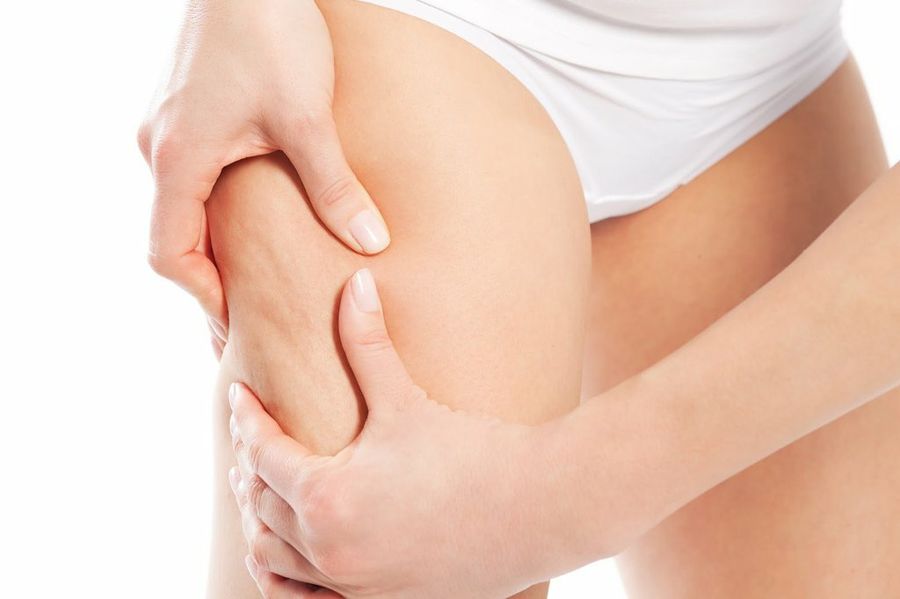Aceite de coco: lo mejor contra la celulitis